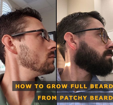 Featured Image of How to Grow Full Beard From Patchy Beard